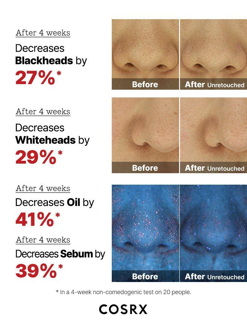 AHA2BHA2-Blemish-07-2-900x-13959