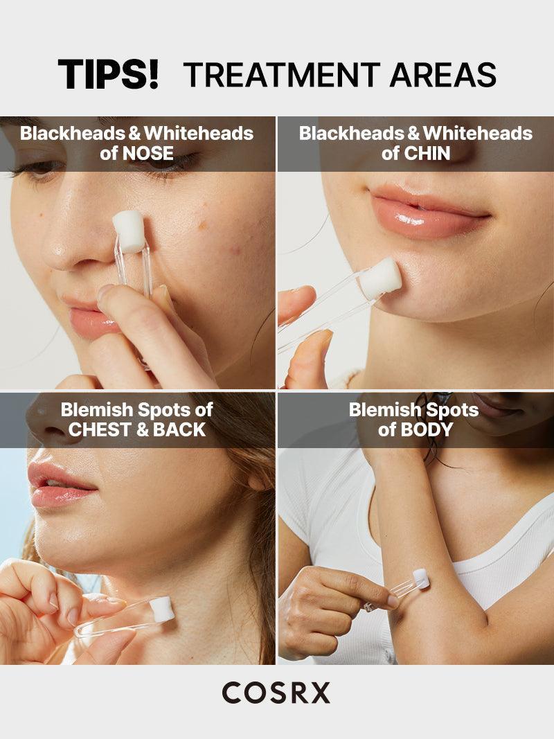 AHA2BHA2-Blemish-14-2-13965